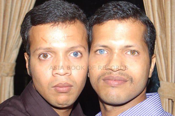 humans with two different colored eyes